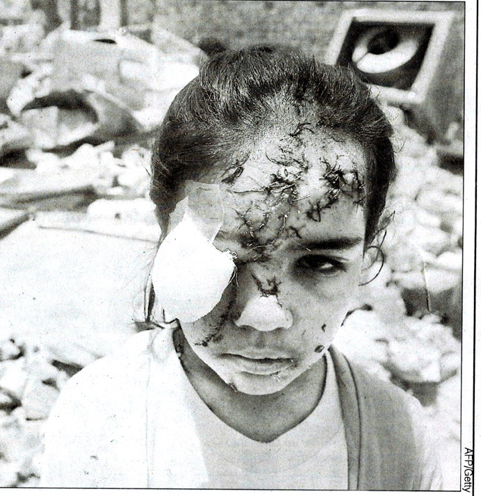 car_bomb_child_survivor.jpg