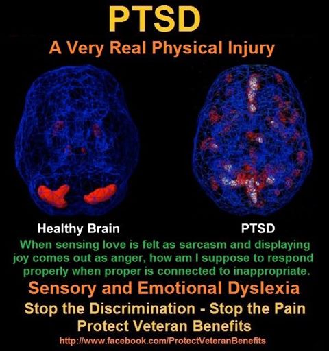 stop_ptsd_discrimination.jpg